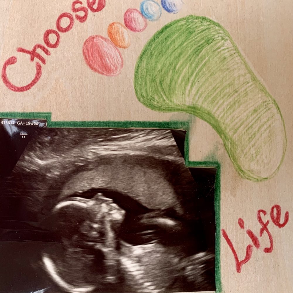 choose life